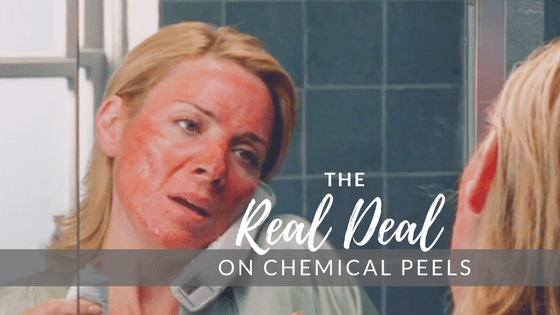 Will a Chemical Peel Make Me Look Like Samantha from Sex & the City? -  Timeless Skin Solutions