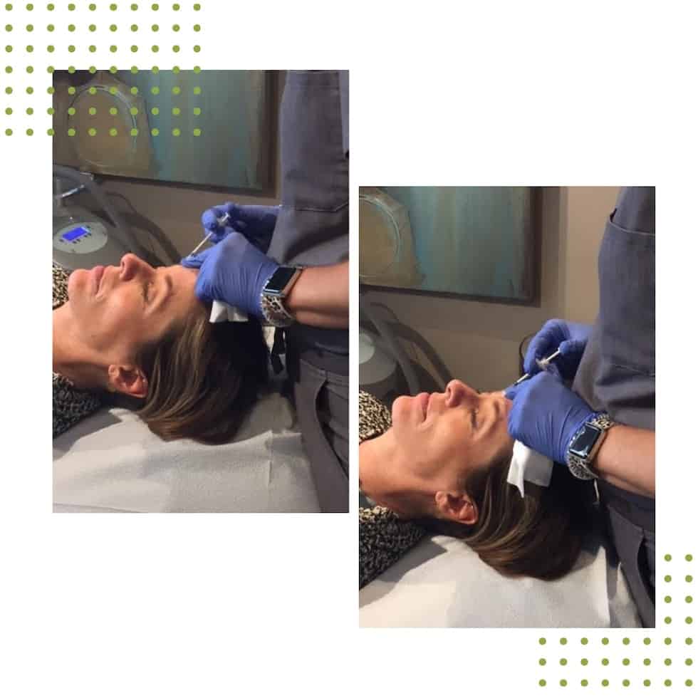 A woman getting Botox injections.